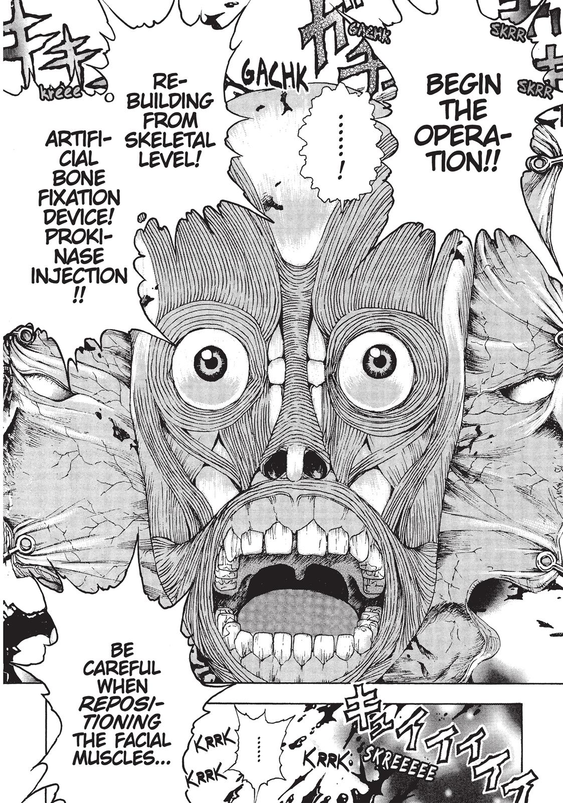 Read Franken Fran Manga Online