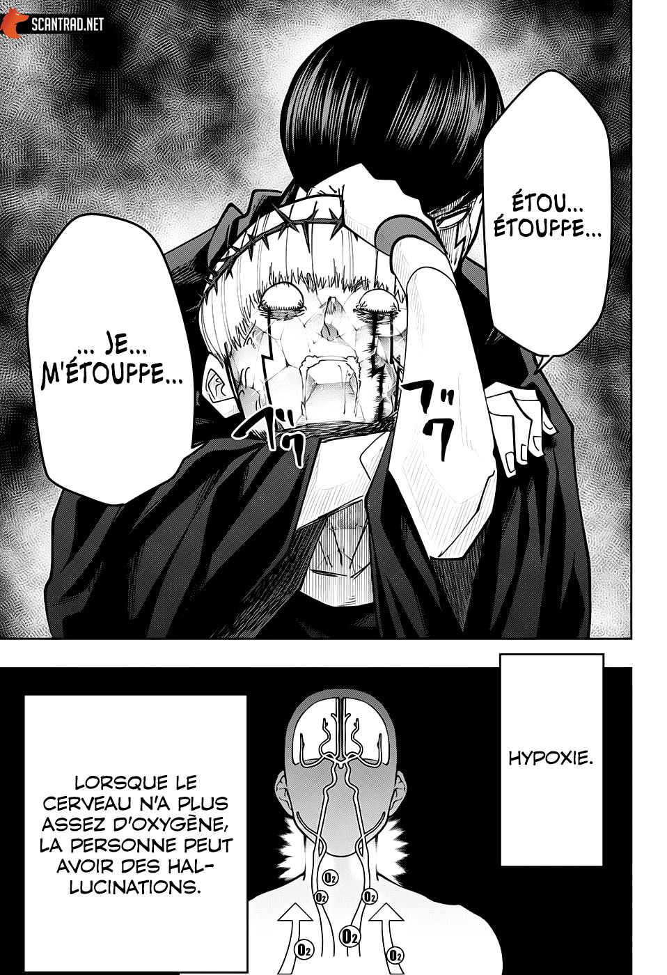 Read Mashle_ Magic and Muscles FR Manga Online